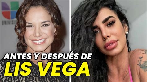 lis vega antes|El increíble antes y después de Lis Vega